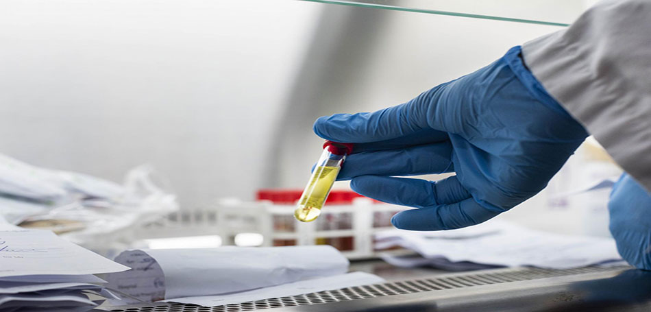 Ελλάδα: Με αρνητικό PCR τεστ 48 ωρών όσοι έρχονται από το εξωτερικό
